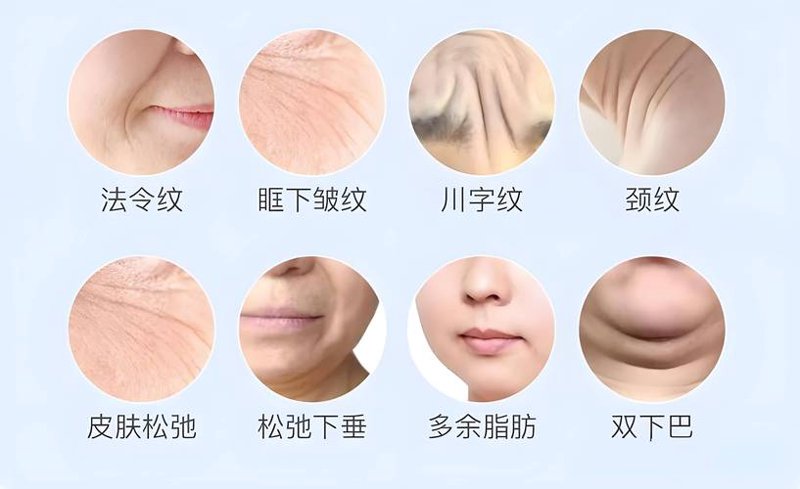 日照皮肤管理：自然光与护肤的完美邂逅