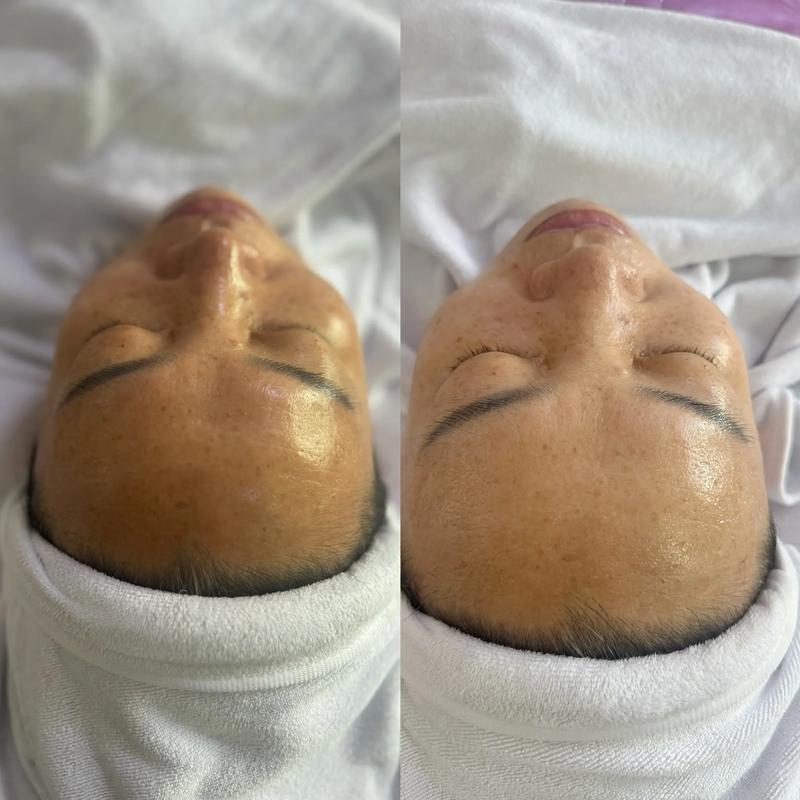 日照皮肤管理